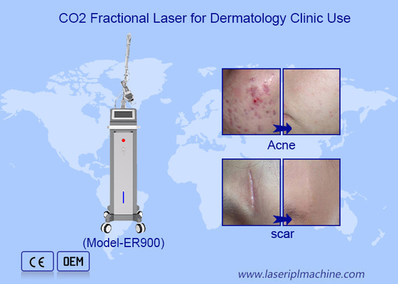 Rimozione dei vasi sanguigni 10600nm Laser frazionato di CO2 Macchina di rifacimento della pelle